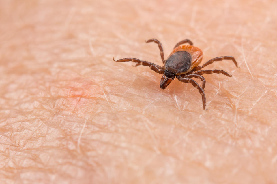 A closeup of a blacklegged tick on a person's skin. (Photo via Getty Images)