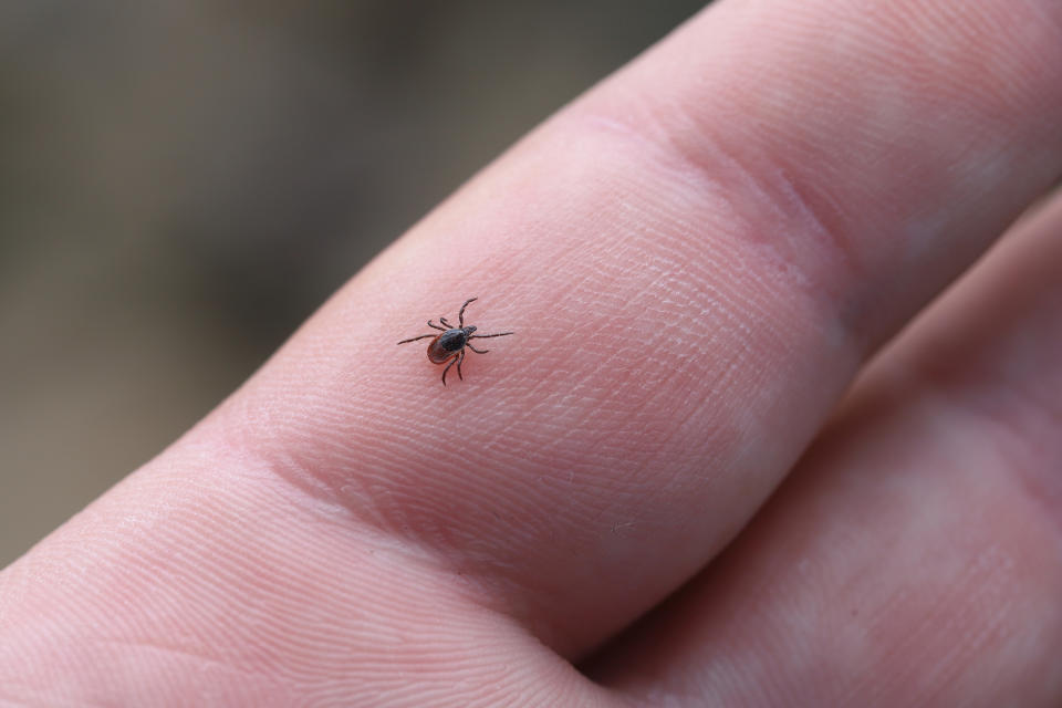A tick walks on a persons hand. (Photo via Getty Images)