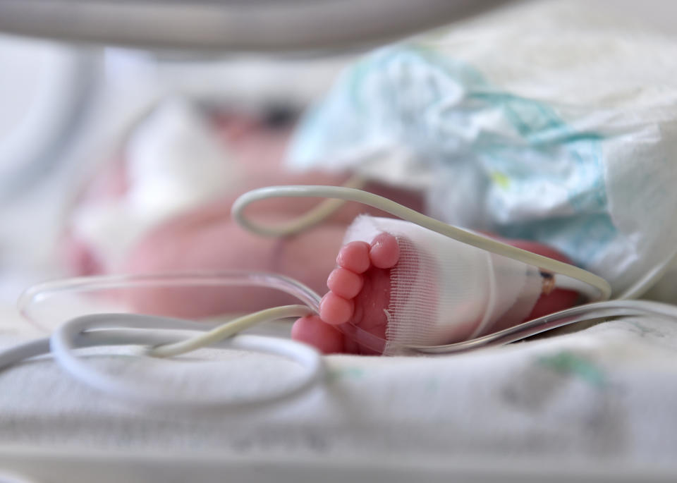 A close-up of a newborn in a hospital, showing the baby's small foot with medical tubes, depicting early care in a neonatal intensive care unit (NICU)
